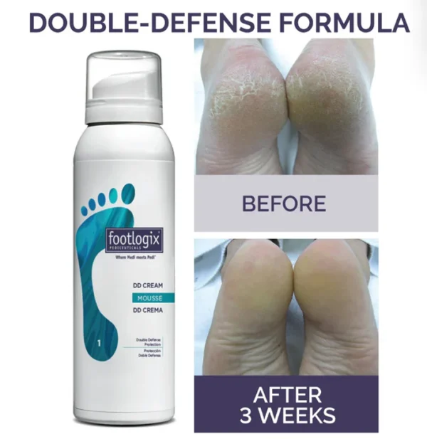 Footlogix "DD CREAM MOUSSE" double defense cream mousse voor droge, gebarsten huid en eelt - Afbeelding 5